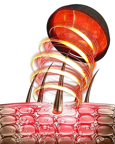 KTS Rotlicht Haarwachstumskappe, 620nm Rotlicht & 460nm Blaulicht Duales Lichtspektrum für die Kopfhautpflege,Haarausfall-Behandlung für Frauen/Männer,Haarwachstumssystem gegen Haarausfall(Schwarz) von KTS