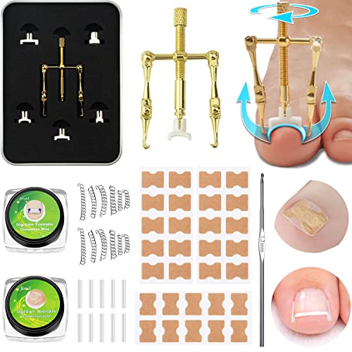 Eingewachsene Zehennägel Set, Zehennagel Korrektur Patch, Korrektor Pediküre, Eingewachsen Zehennägel Streifen, Edelstahl Fusspflege Set Professionell von Leikedun