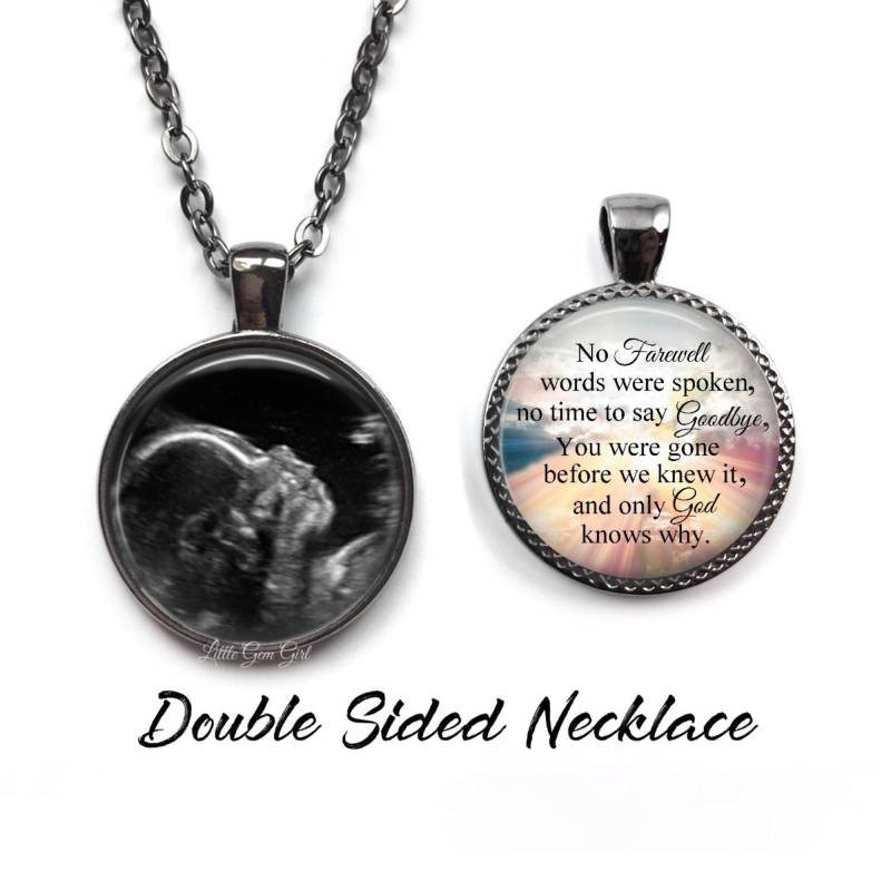 Fehlgeburts-Andenken-Ultraschall-Memorial-Halskette Oder Schlüsselbund - Keine Abschiedsworte Doppelseitiger Benutzerdefinierter Fotoverlust Des von LittleGemGirl
