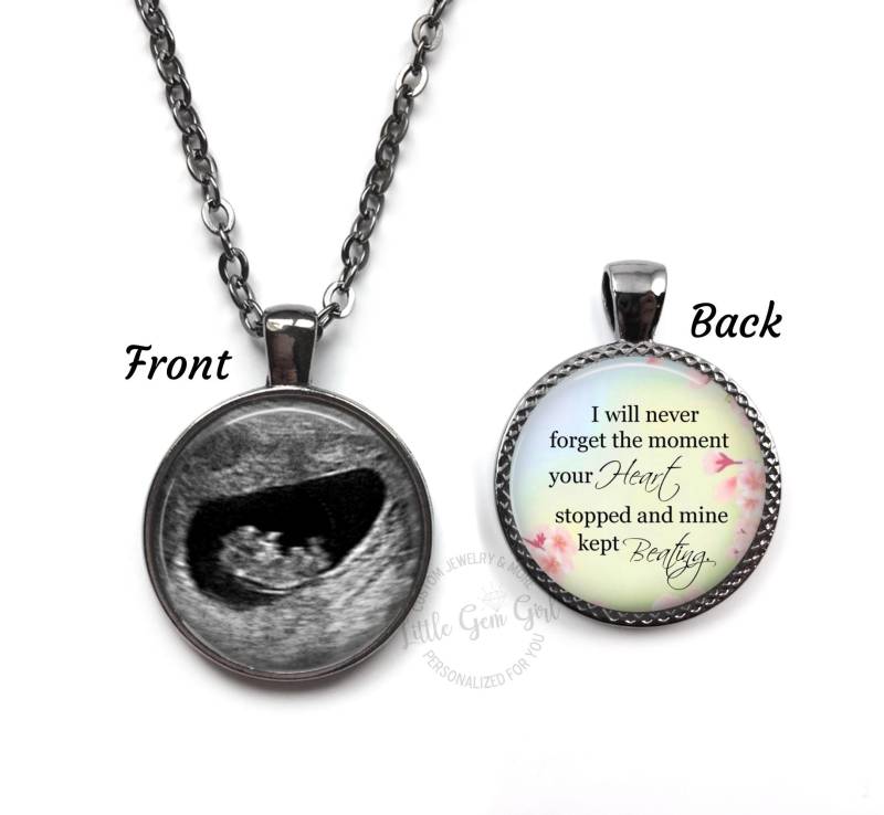 Ultraschall-Memorial-Halskette - Fehlgeburts-Andenken-Schmuck, Doppelseitiger Benutzerdefinierter Foto-Sonogrammanhänger, 23 Designs, 4 von LittleGemGirl