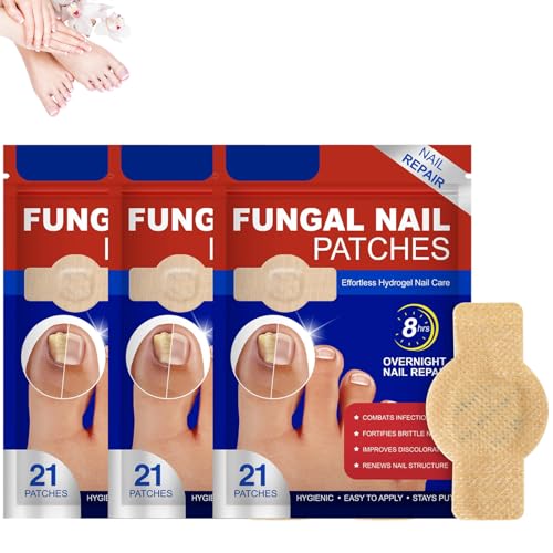 Pilz-Nagel-Patches, Nagelgraben Reparaturpflaster, Mehrzweck Nagelpilz Pflaster, Fungal Nail Patches, Zehennagel Korrektur Patch für Beschädigte Nägel und Erscheinungsbild Verfärbter Nägel (3) von MMQ