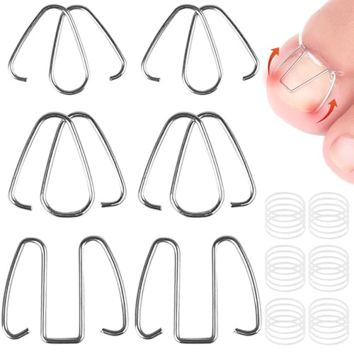4 Box eingewachsene Zehennagelkorrektur, Iron Inggewachsene Zehennagelkorrektoren mit Gummiband, tragbarer Zehennagelkorrektur für Männer Frauen, Zehennagelkorrektur von Mednkoku