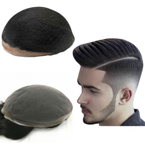 Toupee Für Männer Haarteile Weiche Schweizer Spitze 10x8" Männer Toupee Menschliches Haar Ersatz System für Männer Haarprothese Männer Haar Patch Units Implant für Männer (#1 Jet Black) von Mprosthesis