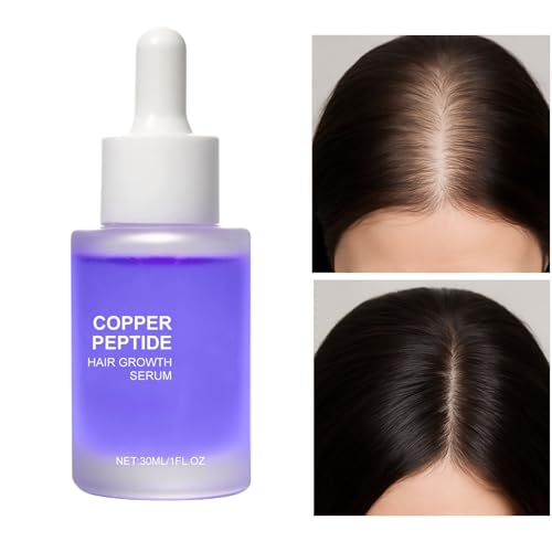 Mxshc Haarwuchs Öl | Gesunde Haar Stärkendes Wachstum 30ml | Milde Tragbare Tägliche Pflege Accessoires - Kopfhaut Pflege Für Frauen Familie Freunde Partner Tochter Mutter Mxshc Haarwuchs Öl | Gesunde Haar Stärkendes Wachstum 30ml | Milde Tragbare Tägliche Pflege Accessoires - Kopfhaut Pflege Für Frauen Familie Freunde Partner Tochter Mutter von Mxshc