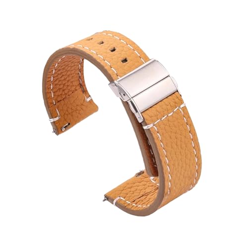 NXNONEPD 18/20/22/24mm Frauen Männer weiche echte Leder -Smart Watchband mit Schnellveröffentlichung Springbar von NXNONEPD