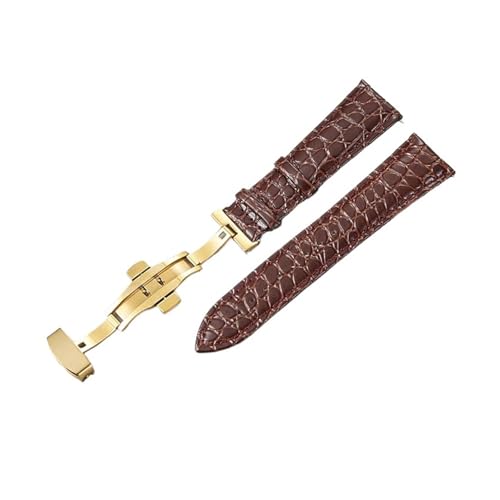NXNONEPD Muster Design Leder Uhrenband 18mm 20 mm 22 mm 24 mm Frauen Männer Ersatzgürtel Uhr Accessoires Handgelenksbänder von NXNONEPD