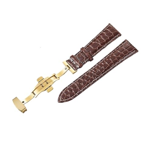 NXNONEPD Muster Design Leder Uhrenband 18mm 20 mm 22 mm 24 mm Frauen Männer Ersatzgürtel Uhr Accessoires Handgelenksbänder von NXNONEPD