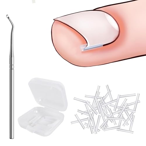 Zehennagel Korrektur,Eingewachsene Zehennägel Set,Zehennagel Eingewachsen, Set Für Eingewachsene Zehennägel, Korrektor Für Eingewachsene Zehennägel, Kit Für Eingewachsene Zehennägel Für Frauen Männer von Naapesi