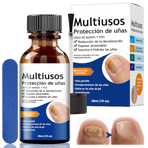 Nagelpflege Behandlung 30ml, Nagelpflege Serum, Intensiv Nagelöl für Männer und Frauen, Tiefenpflege für geschwächte Nägel, Regeneriert Nagelstruktur, Repariert rissige und splitternde Näge von Nimisyra