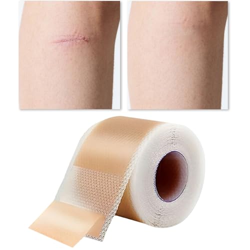 Silikonfolien für Narben, Silikon-Gel-Blätter für Narben, Hautreparaturstreifen für Hals, Hände, Arme, tägliche Pflege, Damen, Herren, Teenager, ältere Menschen, Erwachsene, Mutter von Nuytghr