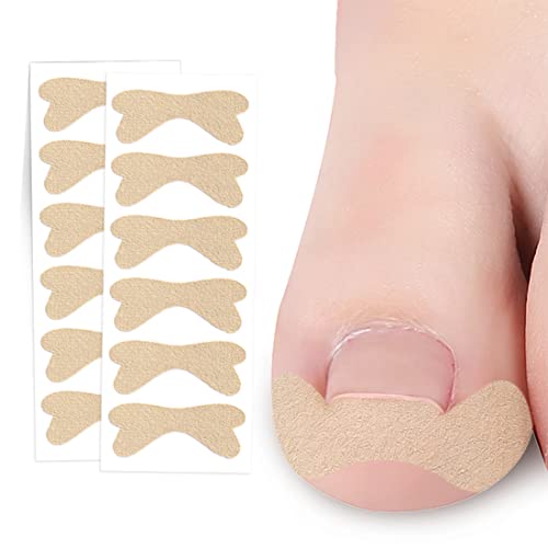 PLABBDPL Zehennägel Korrektur Patch, 40Pcs Eingewachsene Zehennägel Aufkleber, Zehennagel Korrektur, Toenail Correction Patch, Ingrown Toenail Stick Patch, Pediküre Aufkleber Zehennagel Patch von PLABBDPL