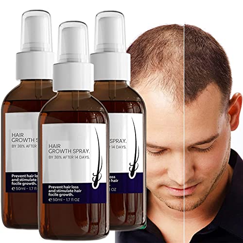 Blusoms Haarwachstumsformel-Serum-Spray, Blusoms, Haarwachstumsformel, Serumspray, Ashwagandha 4500 Haarwachstumsspray, Anti-Haarausfall-Serum für trockenes, krauses, geschädigtes Haar (3 Stück) von Pelinuar