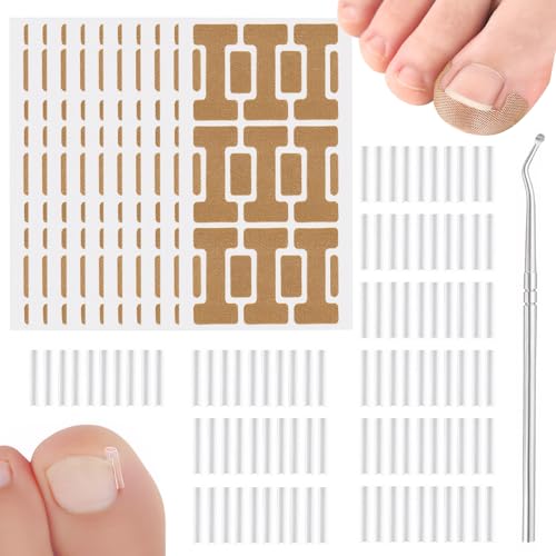 Eingewachsene Zehennägel Set,Eingewachsene Zehennägel,Nagelspange Fußnägel,Enthält 100 C-Förmige Pads Gegen Eingewachsene Zehennägel,1 Nagelentferner,210 Aufkleber Gegen Eingewachsene Zehennägel Eingewachsene Zehennägel Set,Eingewachsene Zehennägel,Nagelspange Fußnägel,Enthält 100 C-Förmige Pads Gegen Eingewachsene Zehennägel,1 Nagelentferner,210 Aufkleber Gegen Eingewachsene Zehennägel von Pluvyze