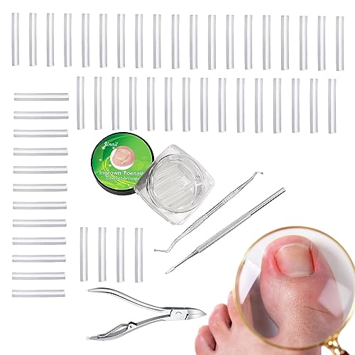 Eingewachsenes Nagelset,C-förmiger Zehennagelknipser Nagelkorrekturwerkzeug | Professionelles Pediküre-Werkzeug mit eingewachsenem Zehennagelheber für Frauen Raxove von Raxove
