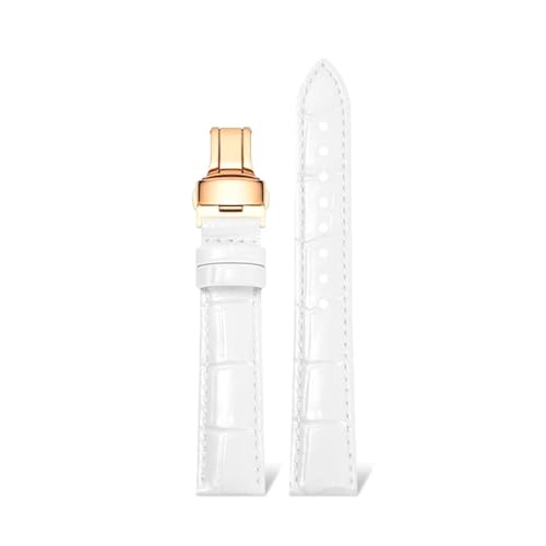 Rodsah Farbiges Leder-Uhrenarmband, glänzend, 12–22 mm, universelles Uhrenarmband, wasserdicht,20mm von Rodsah