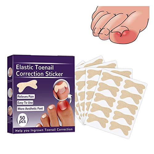 Zehennagel Korrektur Patch,Zehennagel Patch,Eingewachsene Zehennägel Pflaster,Zehennagelkorrektor Pediküre Werkzeug,Toenail Correction Patch,Ingrown Toenail Stick Patch,50pcs von SEGMINISMART