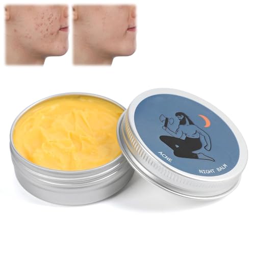 Norse Organics Akne, Norse Organics Akne & Redness Killer, Norse Organics Acne Balm Akne Entferner Creme für Männer, Hautpflegeset zur Entfernung von Akne (1 Stück) von TEPELL
