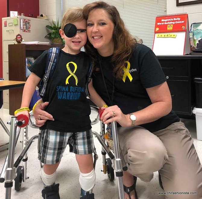 Spina Bifida Krieger/Bewusstsein Bifda Shirt Bewusstseinsmonat Besondere Bedürfnisse Kinder Medizinisch Fragiles Kind Spina Bifida Krieger/Bewusstsein Bifda Shirt Bewusstseinsmonat Besondere Bedürfnisse Kinder Medizinisch Fragiles Kind von TeesbyTCH