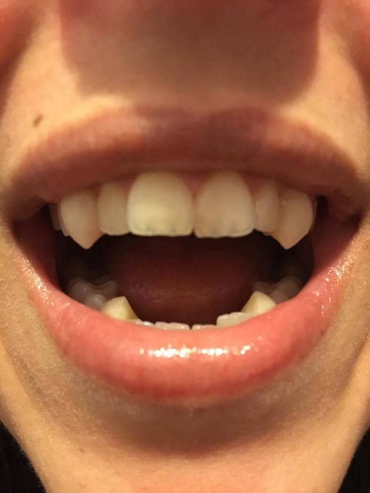 Cat Fangs | Bitte Artikelbeschreibung Lesen von VincentPsykic