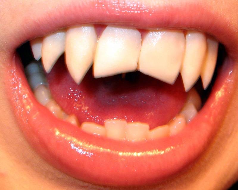 Ginger Snaps Reißzähne | Bitte Artikelbeschreibung Lesen von VincentPsykic