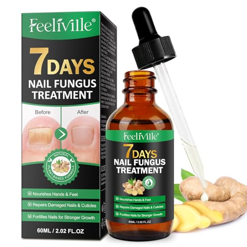 Ginger Intensiv-Nagelpflege für Zehen- & Fingernägel - Natürliche Formel zur Nagelstärkung - 60ml Ginger Intensiv-Nagelpflege für Zehen- & Fingernägel - Natürliche Formel zur Nagelstärkung - 60ml von WINE LIP TINT