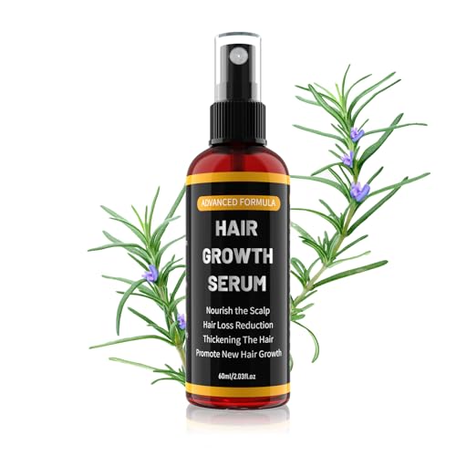 Männer und Frauen Gegen Haarausfall Spray, Mit Hair Growth Rosmarinöl für Dünnes Haare ，Bartwuchsmittel Männer60ml-01 von YaaHei
