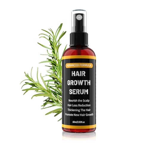 Männer und Frauen Gegen Haarausfall Spray, Mit Hair Growth Rosmarinöl für Dünnes Haare ，Bartwuchsmittel Männer60ml-011 von YaaHei