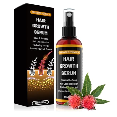 Männer und Frauen Gegen Haarausfall Spray, Mit Hair Growth Rosmarinöl für Dünnes Haare ,Bartwuchsmittel Männer60ml-03 Männer und Frauen Gegen Haarausfall Spray, Mit Hair Growth Rosmarinöl für Dünnes Haare ,Bartwuchsmittel Männer60ml-03 von YaaHei