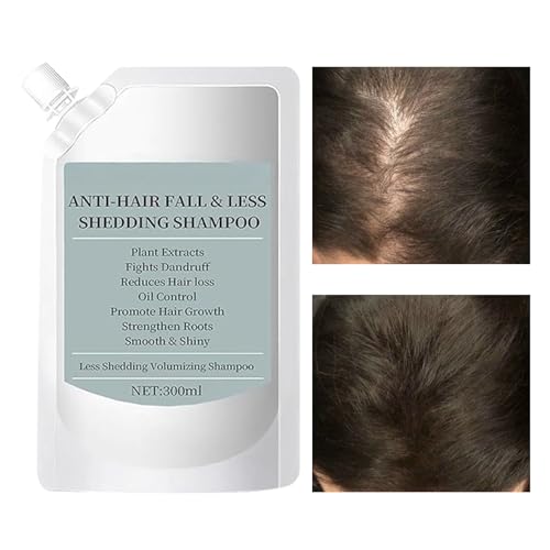 Yongmcxhhj Shampoo Für Feines Haar,Shampoo Zur Stärkung Von Lockigem Und Glattem Haar - 300ml Reinigende Kosmetik Mit Pflanzlichen Extrakten,Für Die Tägliche Haarwäsche Frauen Männer Familie von Yongmcxhhj