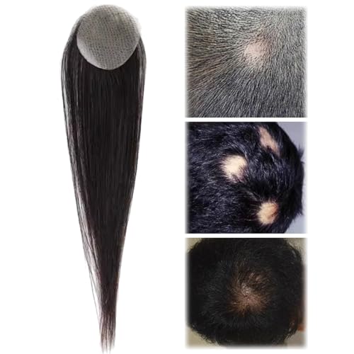 Haar-Patch-Toupet mit kahlen Stellen, ultradünne Haut-V-Loop-Toupet-Haaransatz-Perücken für Männer und Frauen(black,1.8cm) von ZBYXPP