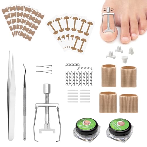 Eingewachsene Zehennägel Set Zehennagel Korrektur Patch Korrektor Pediküre Edelstahl Fusspflege Set Professionell für Paronychie Eingewachsene Fußnägel Eingewachsene Zehennägel Set Zehennagel Korrektur Patch Korrektor Pediküre Edelstahl Fusspflege Set Professionell für Paronychie Eingewachsene Fußnägel von ZMDMAH