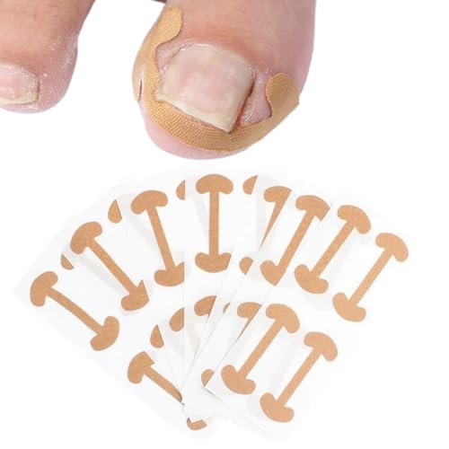 30 Stück Eingewachsener Korrektur Aufkleber, Zehennagel Korrektur Patch, Eingewachsene Zehennägel Nagelspange Fußnägel, Pflaster Zehennagel,Zehennagel Pflaster von ZOWEXIQ