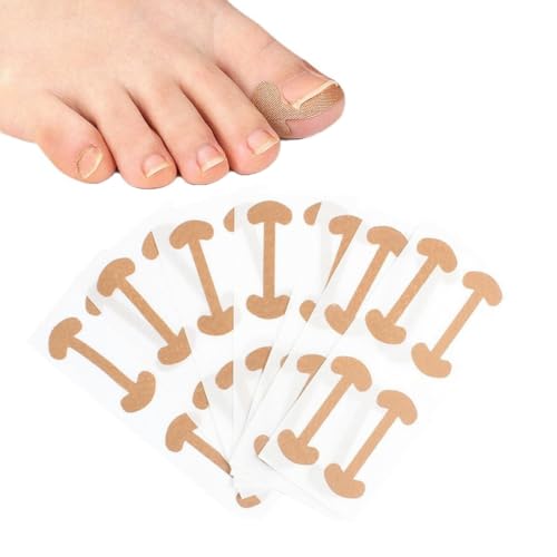 60 Pcs Eingewachsener Korrektur Aufkleber, Zehennagel Korrektur Patch, Eingewachsene Zehennägel Nagelspange Fußnägel, Pflaster Zehennagel,Zehennagel Pflaster von ZOWEXIQ