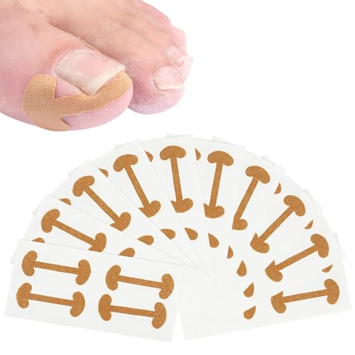 40 Stück Eingewachsene Zehennägel,Zehennagel Korrektur,Eingewachsener Zehennagel,Nagelspange Fußnägel,Nagelspange,Eingewachsene Zehennägel Aufkleber, Für Eingewachsene Zehennägel und Nagelklammern von banjiabb