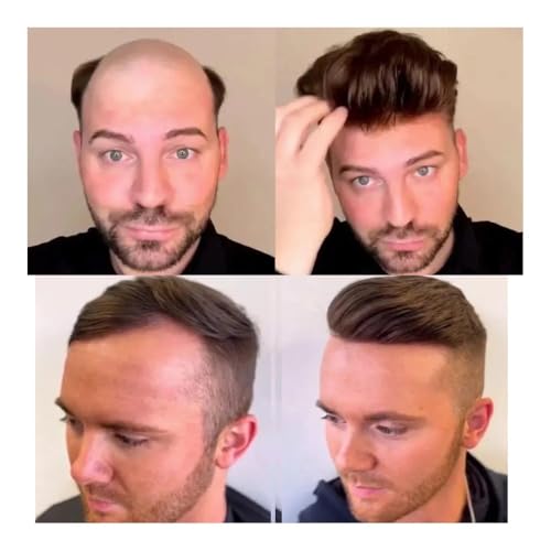 Herren Toupet 0,04 MM Ultra Dünne Haut Männer Haarteil Knotenlose Perücke Männer Volle V-Looped Haar Auf Basis Toupet Männer der Perücke Kapillare Prothese Haar Perücken(#3+10% WHITE) von birene