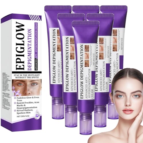 Epiglow Melanex Advanced Anti-Hyperpigmentierungscreme, Anti-Aging-Gesichtscreme, Entferner dunkler Flecken für das Gesicht, Aufhellung von Sommersprossen mit Niacinamid (6) von blmcoos