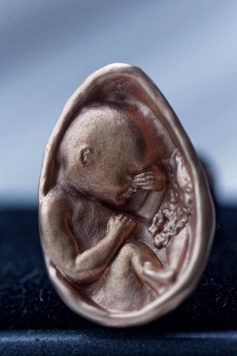Foetus Manschettenknöpfe von customDinoDesigns