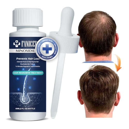 60ML Natürliches Haarwachstum für Männer & Frauen, Haarwuchsmittel zur Förderung von dickerem Haar, Stärkung des Haares und Vorbeugung von Haarausfall, Geschenke für Männer und Vater 60ML Natürliches Haarwachstum für Männer & Frauen, Haarwuchsmittel zur Förderung von dickerem Haar, Stärkung des Haares und Vorbeugung von Haarausfall, Geschenke für Männer und Vater von fanicer