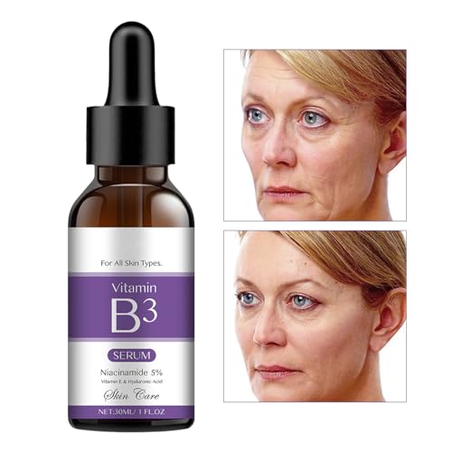Gesichtsfeuchtigkeit | 30ML Leichtgewicht Feuchtigkeitspflege | Straffend Aufhellend Nährend Lösung Für Fahlen Teint Frauen Männer Nachts Nach Duschen Schlafenszeit Saisonal Gesichtsfeuchtigkeit | 30ML Leichtgewicht Feuchtigkeitspflege | Straffend Aufhellend Nährend Lösung Für Fahlen Teint Frauen Männer Nachts Nach Duschen Schlafenszeit Saisonal von higyee