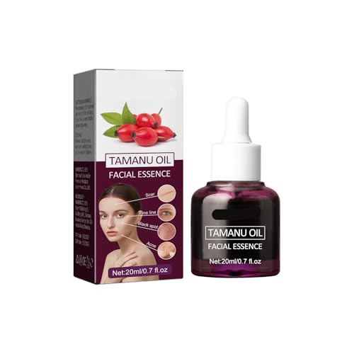 Tamanu-Gesichtsöl – Lässt Aknenarben Verblassen, Reduziert Feine Linien, Spendet Feuchtigkeit Und Strafft Die Haut, Verringert Pigmentierung(3PCs) von hnkhpkl