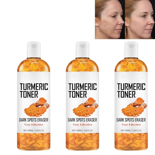 Turmeric Toner, Turmeric Toner Dark Spot Eraser, Turmeric Oil Toner Serum,Dark Spot Remover, Turmeric Toner for Face Anti-Aging Moisturizing, Reduce Dark Spots, Hydrating Facial Toner for Women (3pcs) von homomdy