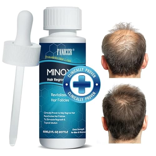 60ML Haarwachstum Serum, Anti Haarausfall Serum für Männer Frauen, zum Haarwachstum beschleunigen, Gesundes Haar Förderung,Tägliche Kopfhautpflege von okalabandee