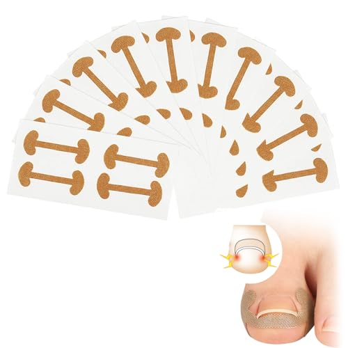 40 Stück Zehennagel Korrektur Patch,Eingewachsene Zehennägel Nagelspange Fußnägel,Nagelkorrekturspange,Pflaster Zehennagel,Zehennagel Pflaster für Behandeln Eingewachsener Zehennagel von vcsjw