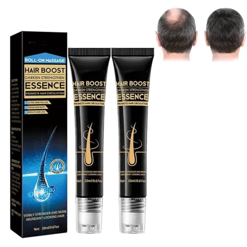 Zozu Biotin Haarwuchs Roll-On Massage-Essenz, Anti-Haarausfall-Serum, Haarwuchs-Serum als Haarmaske und Haarkur Beschleunigen Sie das Haarwachstum, Geeignet für Männer und Frauen (2PC) von vokkrv